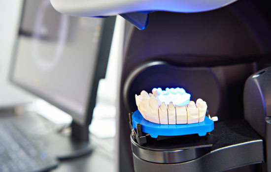 1. Scan your models or use intraoral scans.